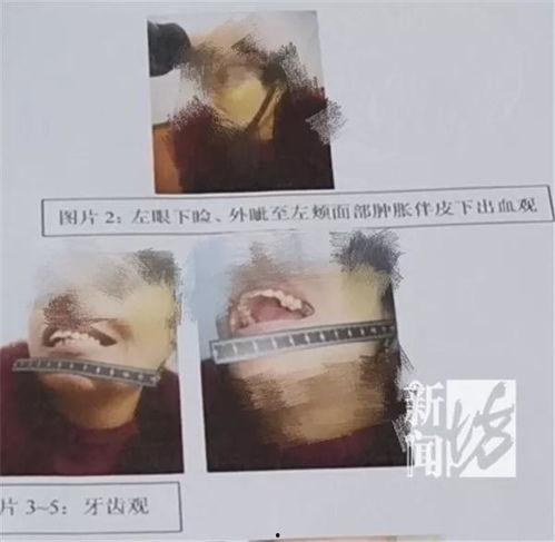 女人打架吃瓜gif